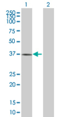 Lane 1: CRHBP transfected lysate (36.1 KDa) Lane 2: Non-transfected lysate.