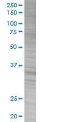 CRHBP transfected lysate.