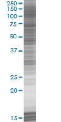 CLEC3B transfected lysate.