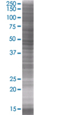 SNIP1 transfected lysate