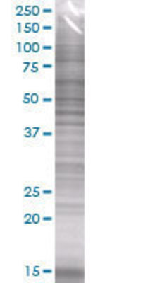 C8orf1 transfected lysate