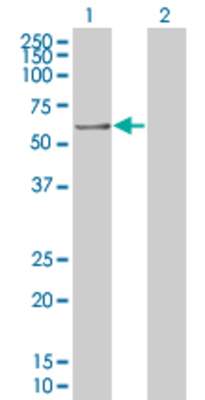 Lane 1: C8orf1 transfected lysate (56.7 KDa). Lane 2: Non-transfected lysate.