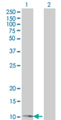 Lane 1: TXN transfected lysate (11.66 KDa). Lane 2: Non-transfected lysate.