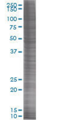 TXN transfected lysate