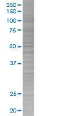 KIR2DL1 transfected lysate.