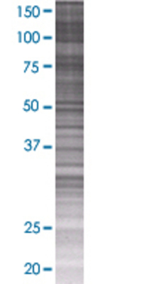 TRAP1 transfected lysate.