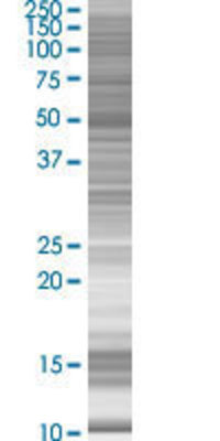 ZNF239 transfected lysate.