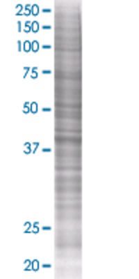 GOT1 transfected lysate.