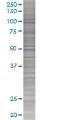 LOC285498 transfected lysate.