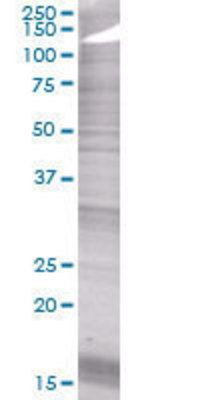 HLA-DPA1 transfected lysate
