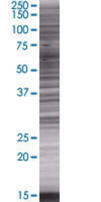 MECR transfected lysate.