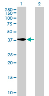 Lane 1: MECR transfected lysate (41.14 KDa) Lane 2: Non-transfected lysate.