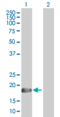 Lane 1: RHEBL1 transfected lysate (20.7 KDa). Lane 2: Non-transfected lysate.