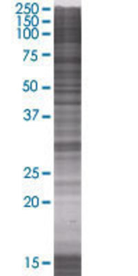 RDHE2 transfected lysate.