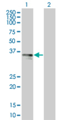 Lane 1: TRAM1 transfected lysate (41.25 KDa). Lane 2: Non-transfected lysate.