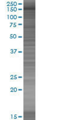 SORBS2 transfected lysate.