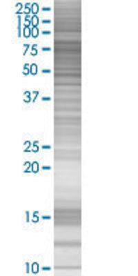 NDUFS1 transfected lysate.