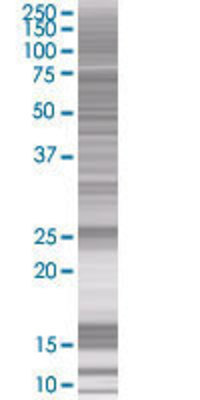 NDUFS8 transfected lysate.