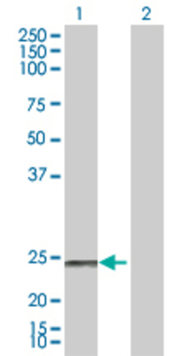 Lane 1: NDUFS8 transfected lysate (23.7 KDa) Lane 2: Non-transfected lysate.