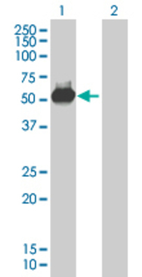 Lane 1: FNTA transfected lysate (41.69 KDa). Lane 2: Non-transfected lysate.
