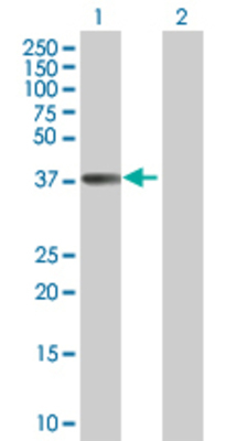 Lane 1: COQ3 transfected lysate (40.7 KDa) Lane 2: Non-transfected lysate.