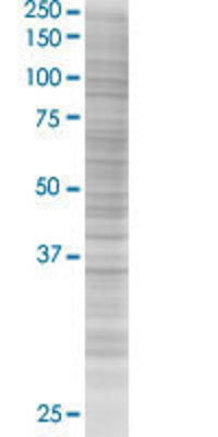 COQ3 transfected lysate.