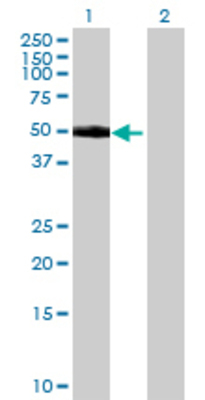 Lane 1: CDCP1 transfected lysate (37.84 KDa) Lane 2: Non-transfected lysate.