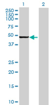 Lane 1: TRNT1 transfected lysate (44.66 KDa) Lane 2: Non-transfected lysate.