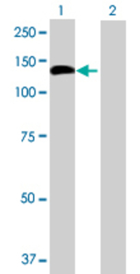 Lane 1: CNTROB transfected lysate (99.44 KDa) Lane 2: Non-transfected lysate.