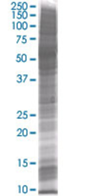 IFITM3 transfected lysate