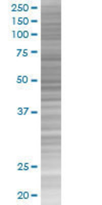 KLF15 transfected lysate.