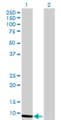 Lane 1: S100A12 transfected lysate (10.23 KDa) Lane 2: Non-transfected lysate.