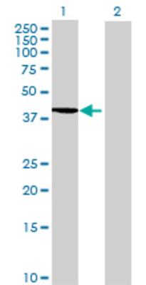 Lane 1: NIF3L1 transfected lysate (38.61 KDa) Lane 2: Non-transfected lysate.