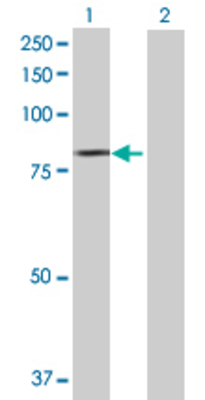 Lane 1: SILV transfected lysate (72.82 KDa) Lane 2: Non-transfected lysate.