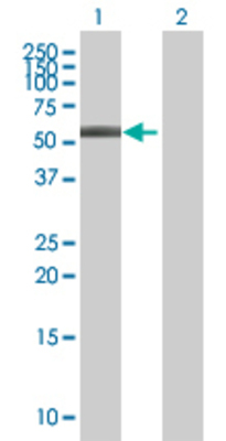 Lane 1: ABLIM3 transfected lysate (61.6 KDa) Lane 2: Non-transfected lysate.