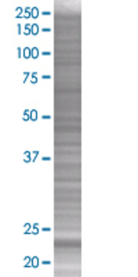MAD2L2 transfected lysate