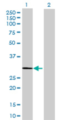 Lane 1: HSD17B11 transfected lysate (33.11 KDa) Lane 2: Non-transfected lysate.
