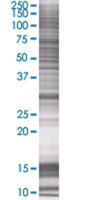 HSD17B11 transfected lysate.