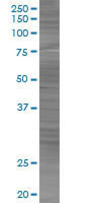 PSME2 transfected lysate.