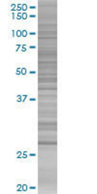 PMM2 transfected lysate.