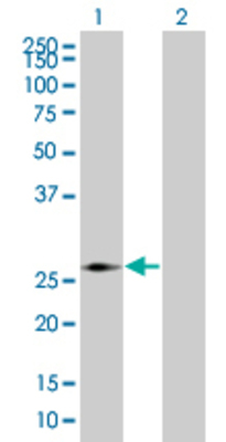 Lane 1: PMM2 transfected lysate (27.17 KDa) Lane 2: Non-transfected lysate.