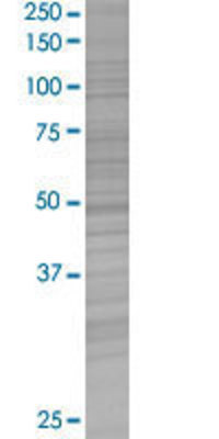 CHRNA4 transfected lysate.