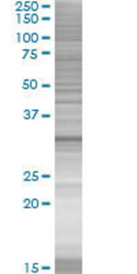 HOXC8 transfected lysate.