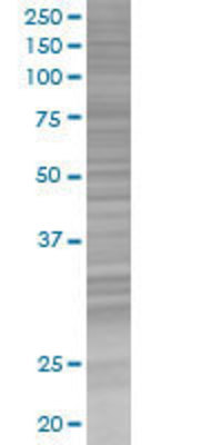 FHL1 transfected lysate.