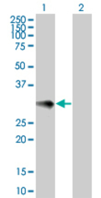 Lane 1: IL9 transfected lysate (15.9 KDa). Lane 2: Non-transfected lysate.