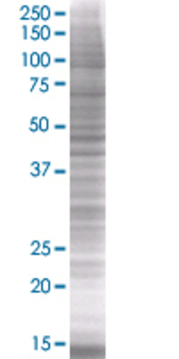 CACNG2 transfected lysate.