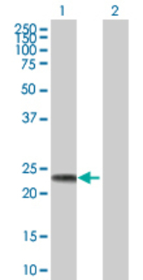 Lane 1: BAG2 transfected lysate (23.8 KDa) Lane 2: Non-transfected lysate.