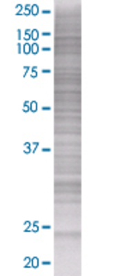 BAG2 transfected lysate.