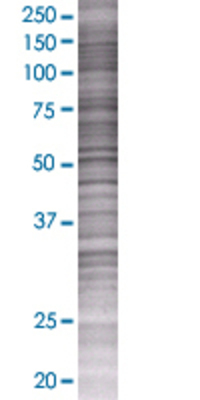 DNAJC19 transfected lysate.