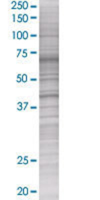TMOD2 transfected lysate.